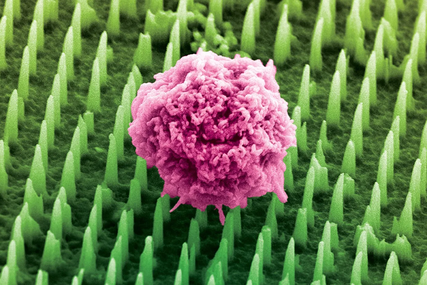 False-coloured electron micrograph of a pink cell sitting on green nanoneedles.