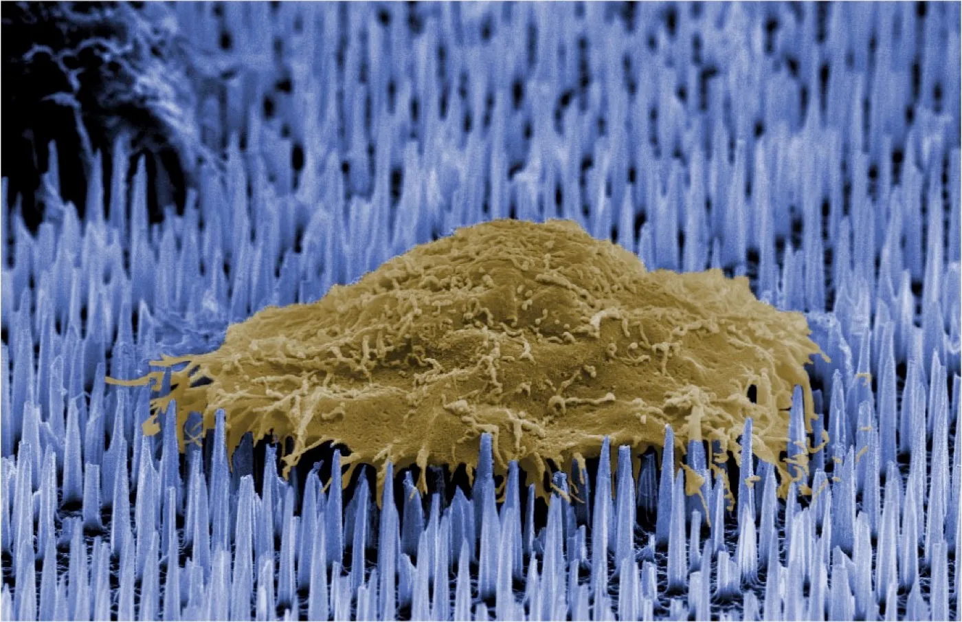 False-coloured electron micrograph of a cell, in gold, resting on a dense array of blue nanoneedles.