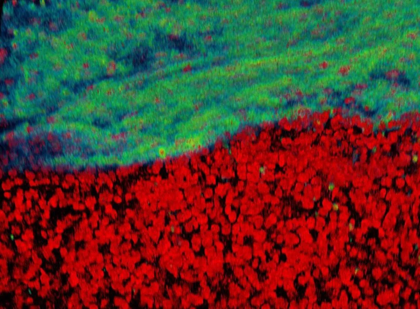 Fluorescence image of tissue with a green-blue region bordering densely packed red-labelled cells.